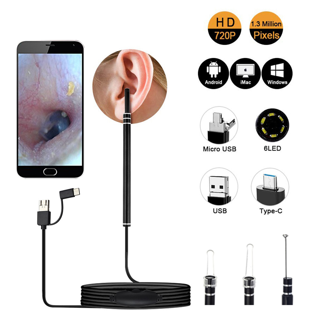 AtHome Ear Endoscope